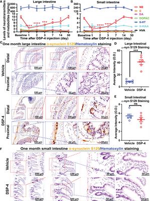 Dysfunction of the noradrenergic system drives inflammation, α-synucleinopathy, and neuronal loss in mouse colon